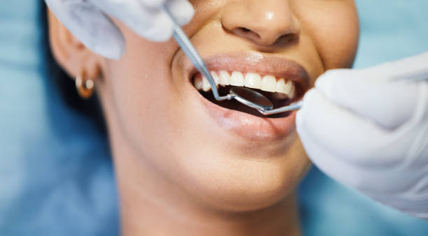 Best Emergency Denture Repair in Frenchtown, NJ