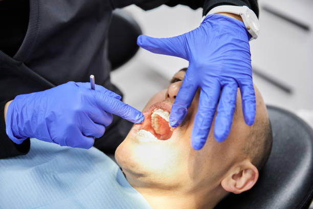 Best Emergency Dental Care for Broken or Chipped Teeth in Frenchtown, NJ